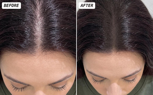 Before and after using hairline shadow powder